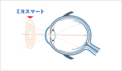 近視抑制用メガネ